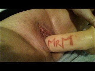 MRM1